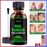 ANTI FUNGAL TREATMENT EXTRA STRENGTH TOENAIL FUNGUS ATHLETES FOOT FUNGI NAIL