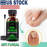 ANTI FUNGAL TREATMENT EXTRA STRENGTH TOENAIL FUNGUS ATHLETES FOOT FUNGI NAIL